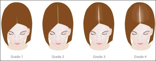 秋冬流行发型，5个秋冬发型技巧