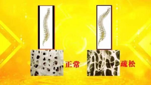 脚走路会肥胖(走路脚胖怎么回事)