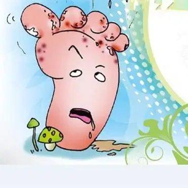 起水痘能把腋臭治好吗(起水痘能把腋臭弄掉吗)