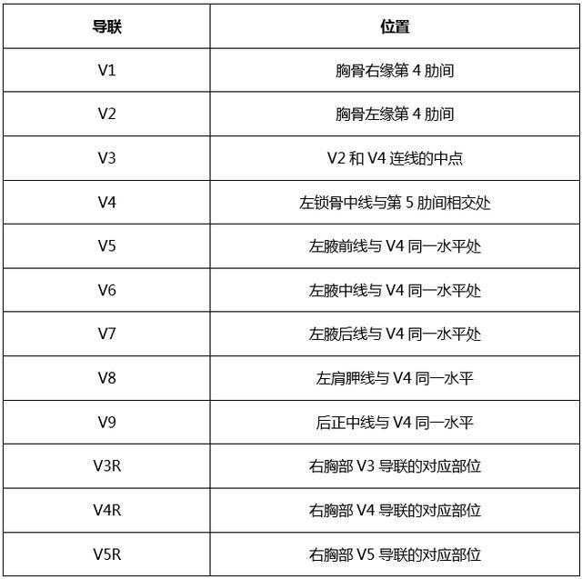 心电图所有导联的放置位置，肢体导联电极错接的心电图分析及鉴别