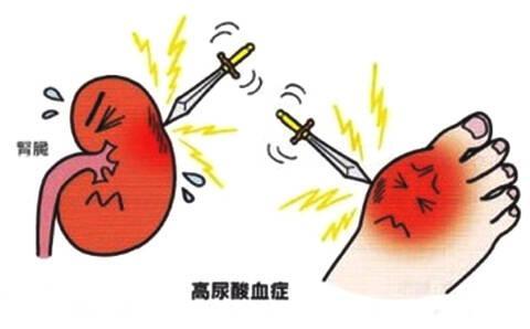 儿童肥胖尿酸高(儿童肥胖尿酸高780必须吃药吗)