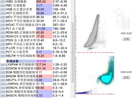 两例超高白细胞计数的案例分享，六分钟带你了解体内白细胞