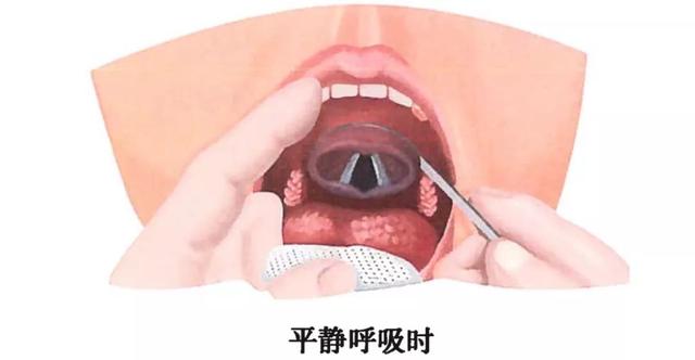 呼吸系统解剖图，呼吸系统解剖图手绘（人体解剖学：呼吸系统）