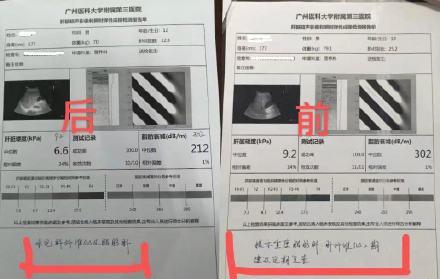 12岁男孩肥胖(12岁男孩肥胖怎样减肥)