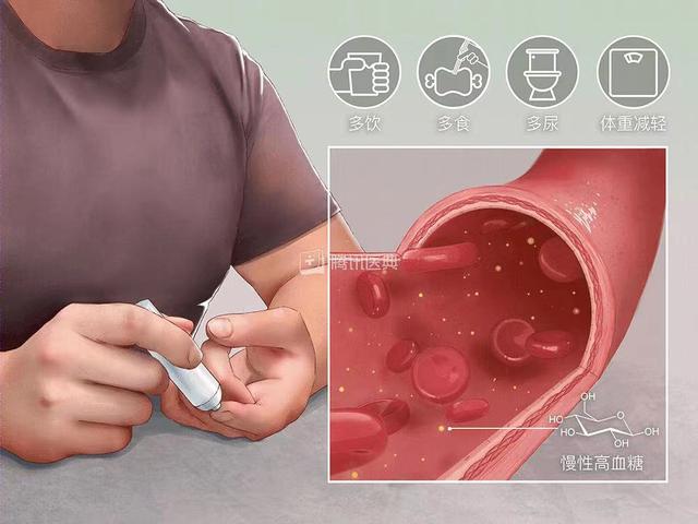 糖尿病乐科普(糖尿病科普小知识简单)
