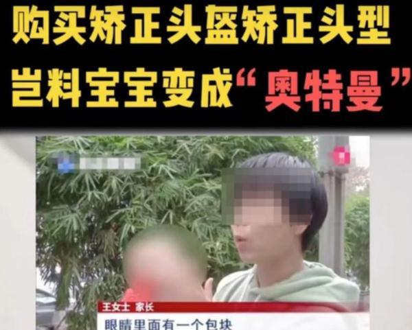 婴儿头型纠正示意图，婴儿头型矫正该矫正