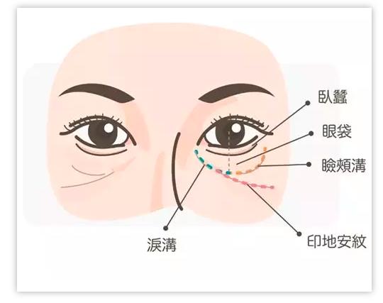 横肥胖纹(肥胖纹横纹竖纹)