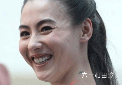 额头有皱纹怎么办，额头有皱纹眼睛下面也有皱纹