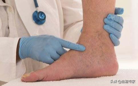 小腿皮肤发黑图片，脚小腿皮肤变黑是什么原因