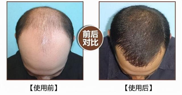 别见了胸就去点离异富婆的广告，里面全是深渊 送女朋友什么礼物