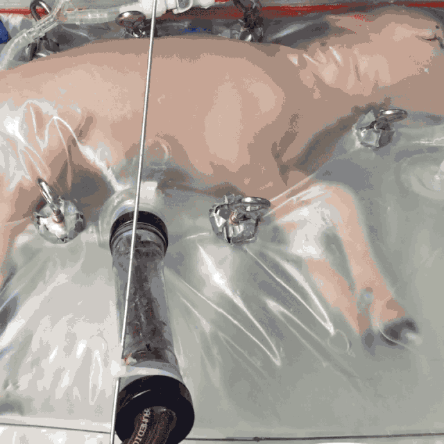 人造子宫几个月可以生孩子，十万八万的也能生个孩子