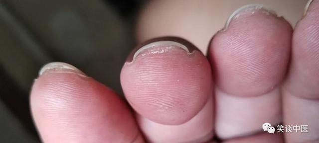 摸脉是摸哪里，摸脉到底用哪里摸