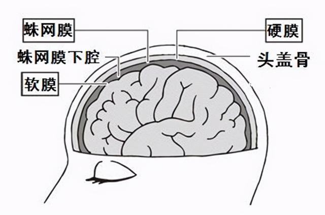 高血压引起的脑出血急救方法，高血压引起的出血性脑中