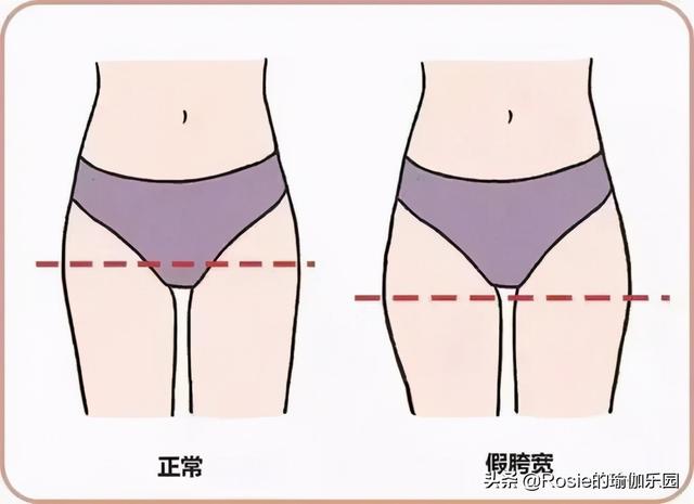 假胯寬、臀肥腿壯？要瘦腿先分清粗腿成因，不走彎路美腿這樣瘦 健身減肥達人 第12张