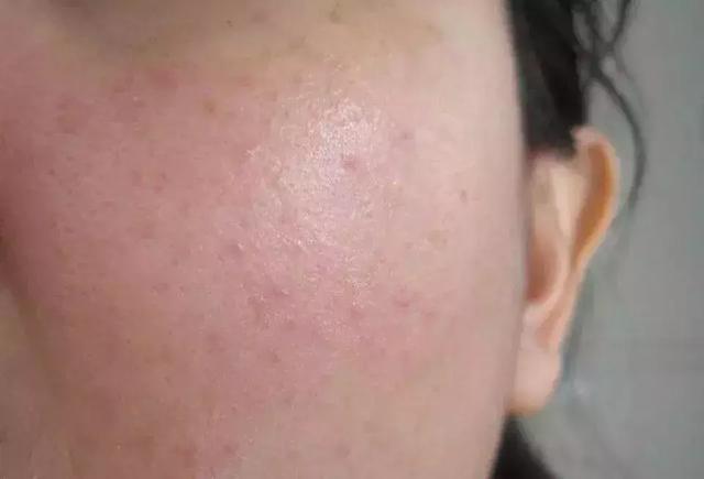 皮肤过敏用什么化妆品，抗敏修护保湿护肤品排行榜10强