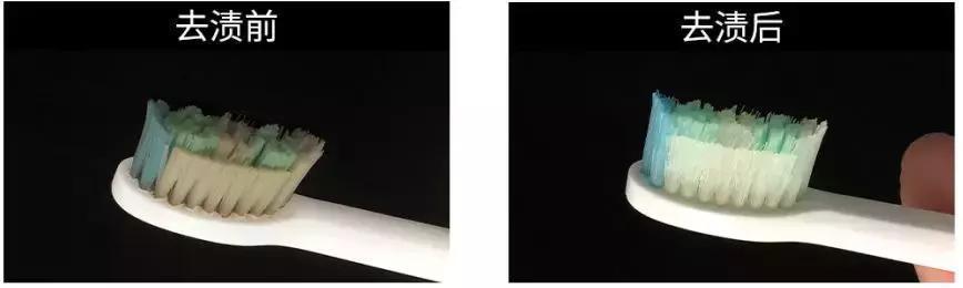 衣服发黄怎么办，小妙招衣服发黄了怎么处理