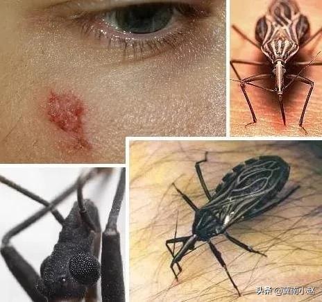 4种常见的可怕昆虫，世界上最毒的十大昆虫