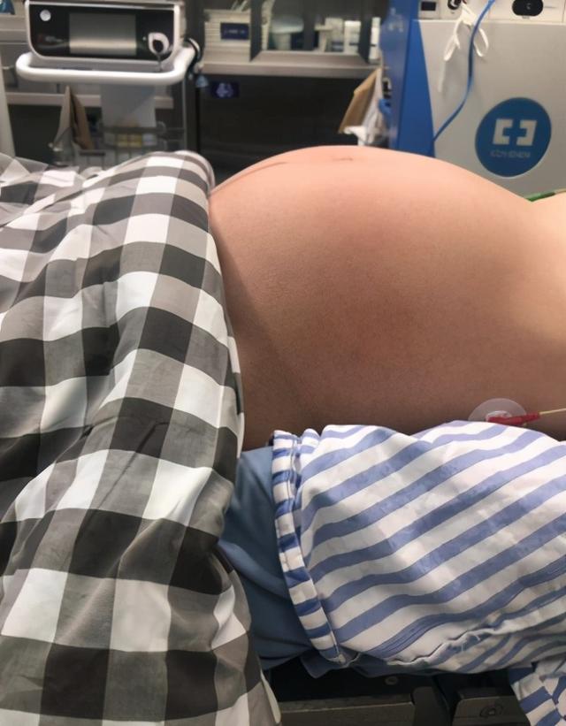 肥胖黄素化(黄素化吃什么药)