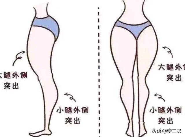 大腿粗有几种类型，你知道大腿粗的真正原因是什么吗