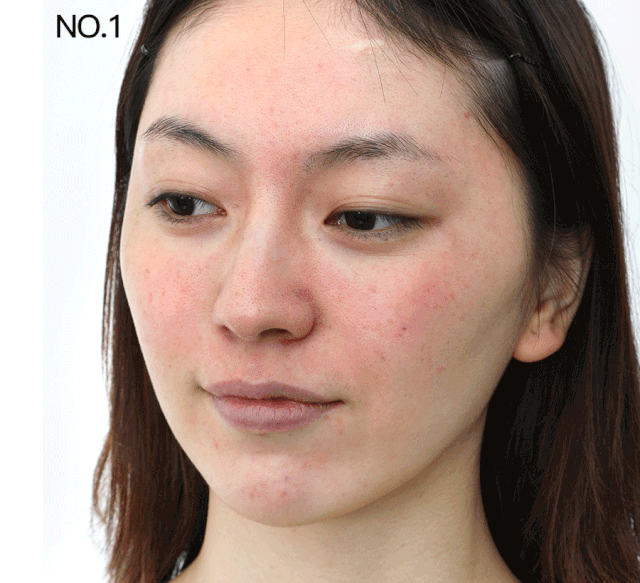 sk2小灯泡多久变白，sk2美白小灯泡正确使用方法（小灯泡、小白瓶、修丽可、科颜氏该买谁）