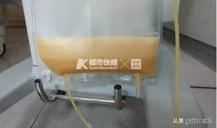 肥胖导致出血(肥胖导致出血怎么办)