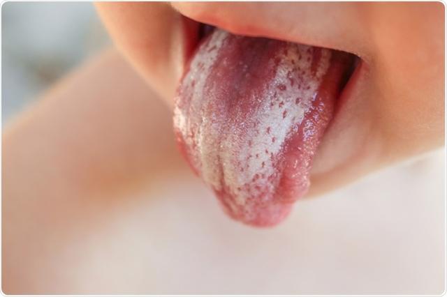 永久花精油的功效，永生花精油香氛（用哪些精油可以抗衰老）