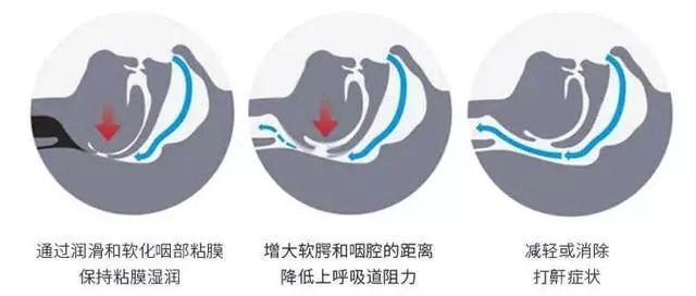 民间止鼾九大妙招，教你一招永不打呼噜小妙招