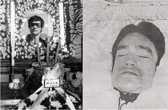 李小龙是怎么死的，李小龙的死亡真实原因（李小龙离奇去世49年）