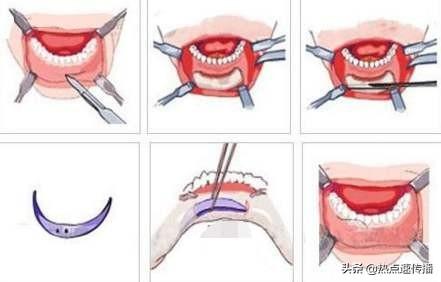 怎么判断下巴是否后缩，最容易下巴后缩的两点原因