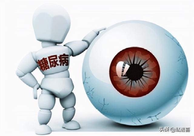 眼屎糖尿病(糖尿病患者眼屎多是什么原因)