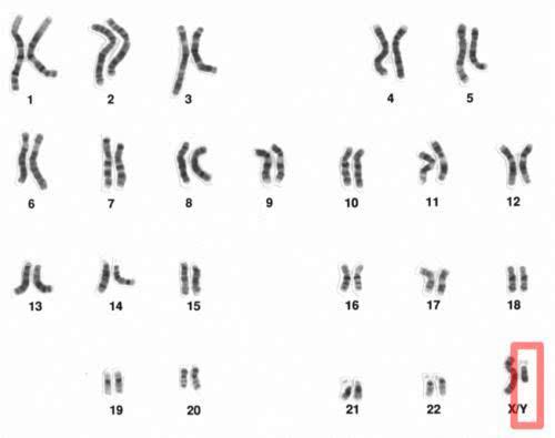 正常人类的染色体数量，科学家最新发现