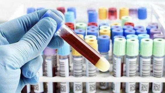 夫妻血型配对表，夫妻双方血型配对表（夫妻如果是这2种血型）