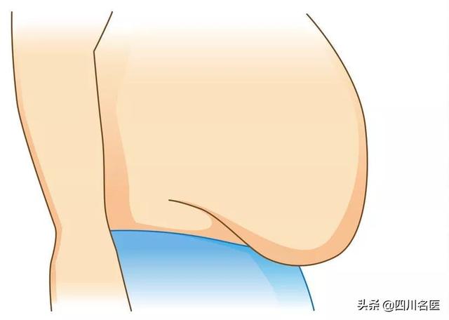 基础性肥胖(肥胖症从基础到临床)