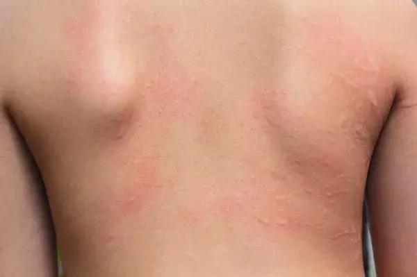 各种皮肤颜色的人，这6种皮肤颜色异常