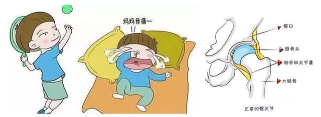 2岁小孩髋关节滑膜炎3周了还没好，原来是过敏性的原因