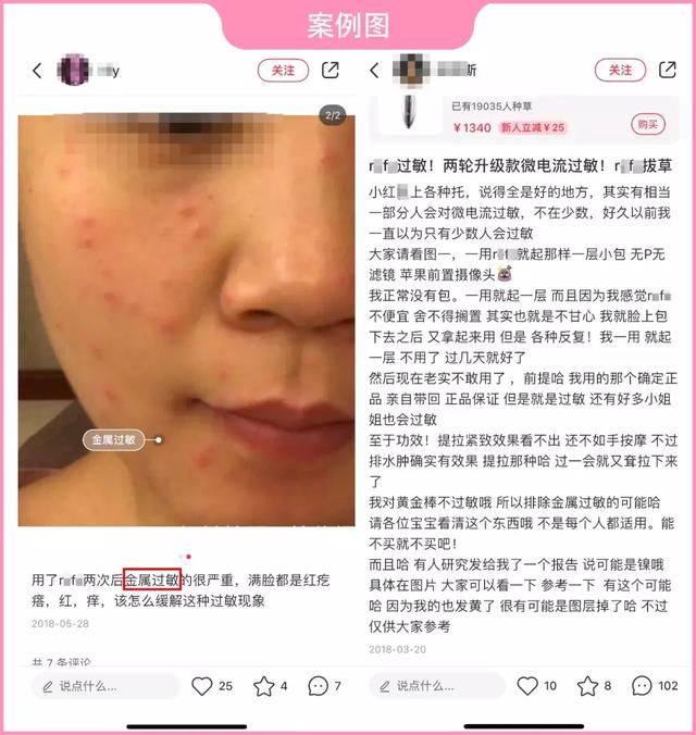 美容仪有必要买吗，美容仪真的有必要用吗（几千元买的美容仪变“毁容仪”）