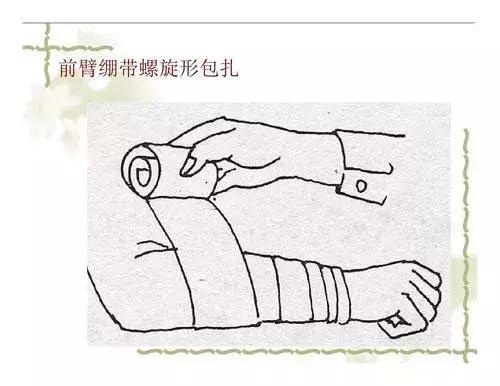 12种急救包扎方法，这4种急救包扎的方法
