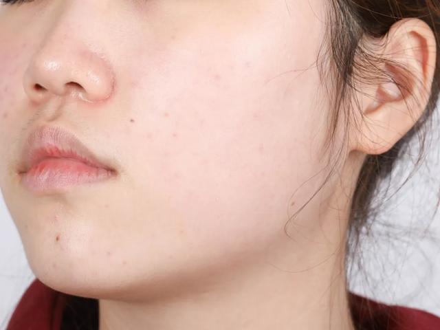 科颜氏白泥面膜的正确使用方法，科颜氏白泥清洁面膜的正确使用（告别油腻，黑头粉刺都给我退）