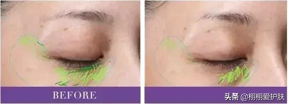 欧莱雅第二代紫熨斗淡纹眼霜，分享几款配置高的眼霜