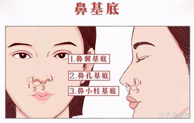 一张图看懂鼻基底凹陷对比图，塌鼻秒变立体质感鼻