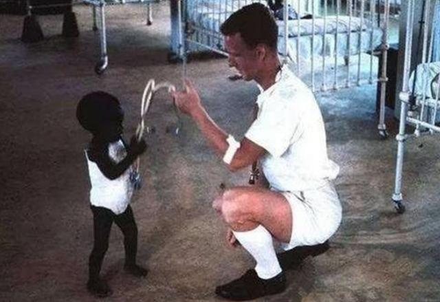 世界上最丑的婴儿，世界上最黑的孩子近照