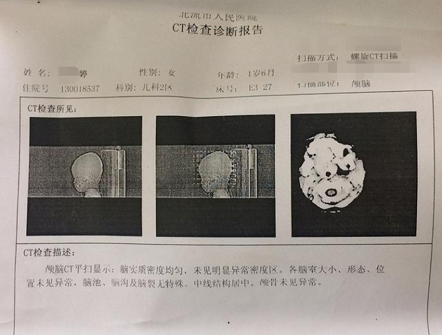 乙性糖尿病(乙性糖尿病是怎么回事)