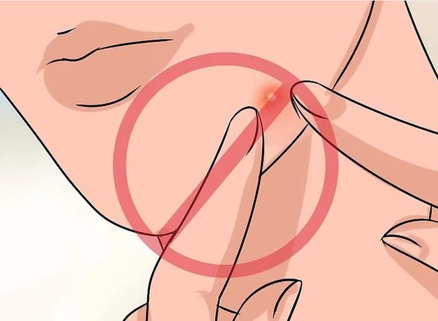 祛痘印最有效的方法无痕，你是如何去祛痘痘印的