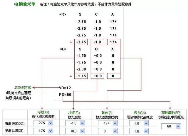 眼睛验光单怎么看，眼科验光检查报告单怎么看（1分钟带你看懂报告单）