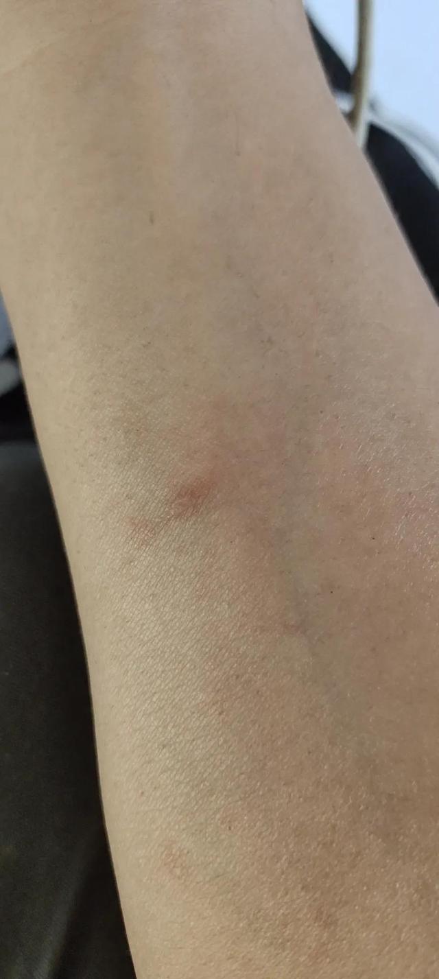 如何在家自己做艾草膏，教你制作无添加艾草薄荷膏