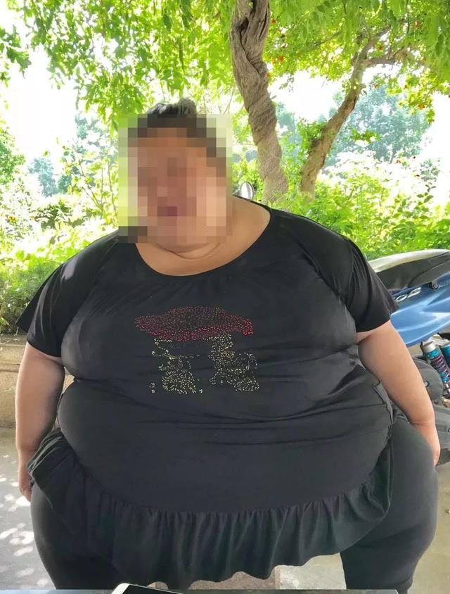 被嘲笑肥胖而自行割肉(被嘲笑肥胖而自卑怎么办)