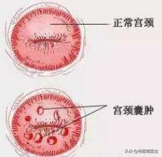 哪种妇科病最严重，你知道哪种妇科病发病率最大（提醒：这4种妇科病看起来可怕）