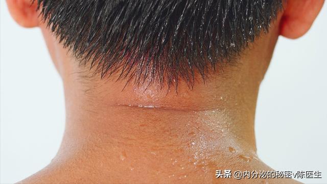 糖尿病汗很黄(糖尿病出的汗特别臭吗)