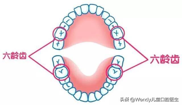 一张刷爆朋友圈的牙片，成年人要做牙齿窝沟封闭
