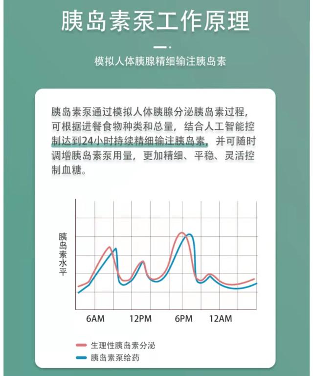 糖尿病带泵怎么洗澡(糖尿病带泵有什坏处)